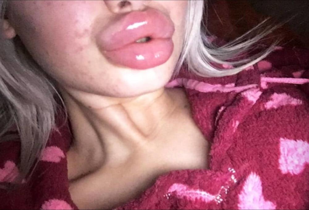 20P Perfect BlowLIPS 001