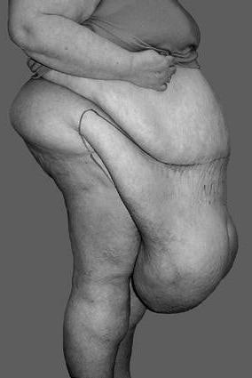 25P Belly To Knees 6