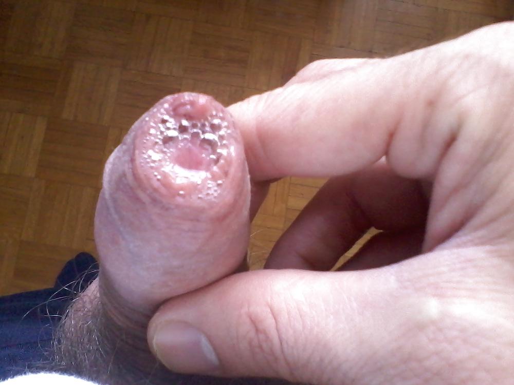 22P Foreskin show