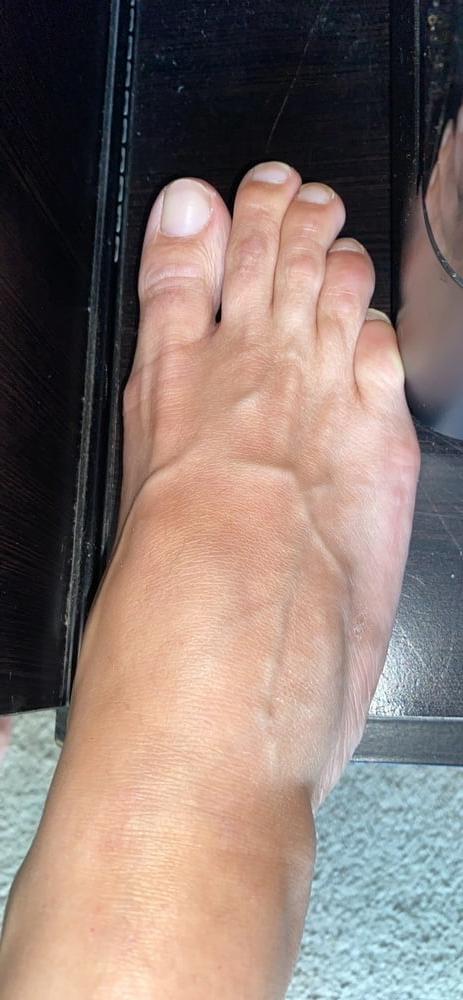 9P Perfect toes