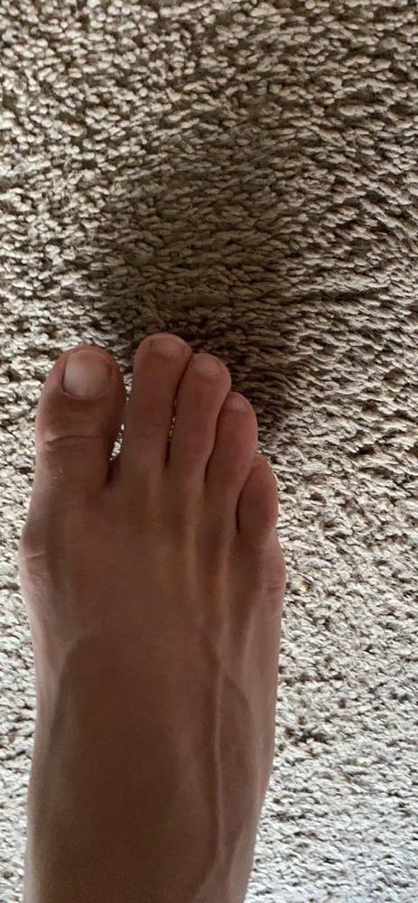 9P Perfect toes