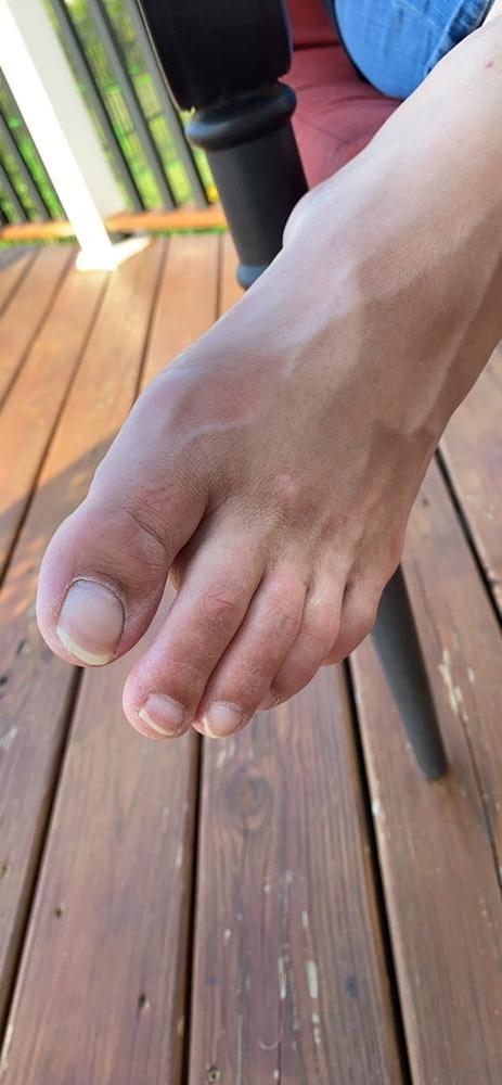 9P Perfect toes