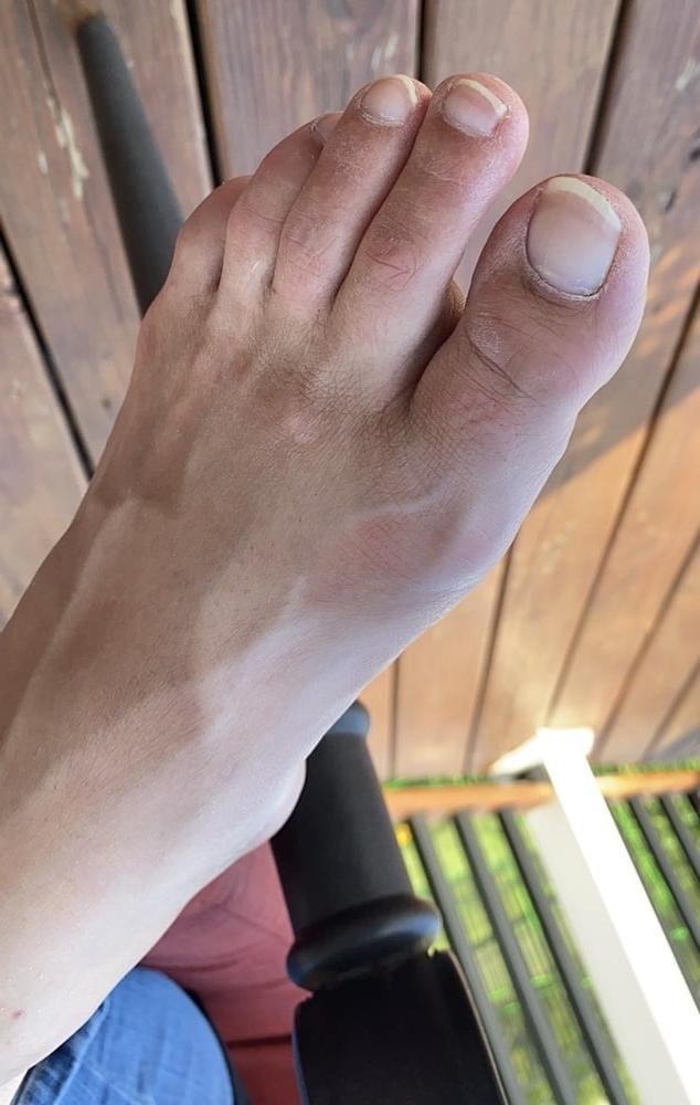 9P Perfect toes