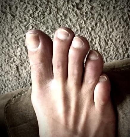 9P Perfect toes