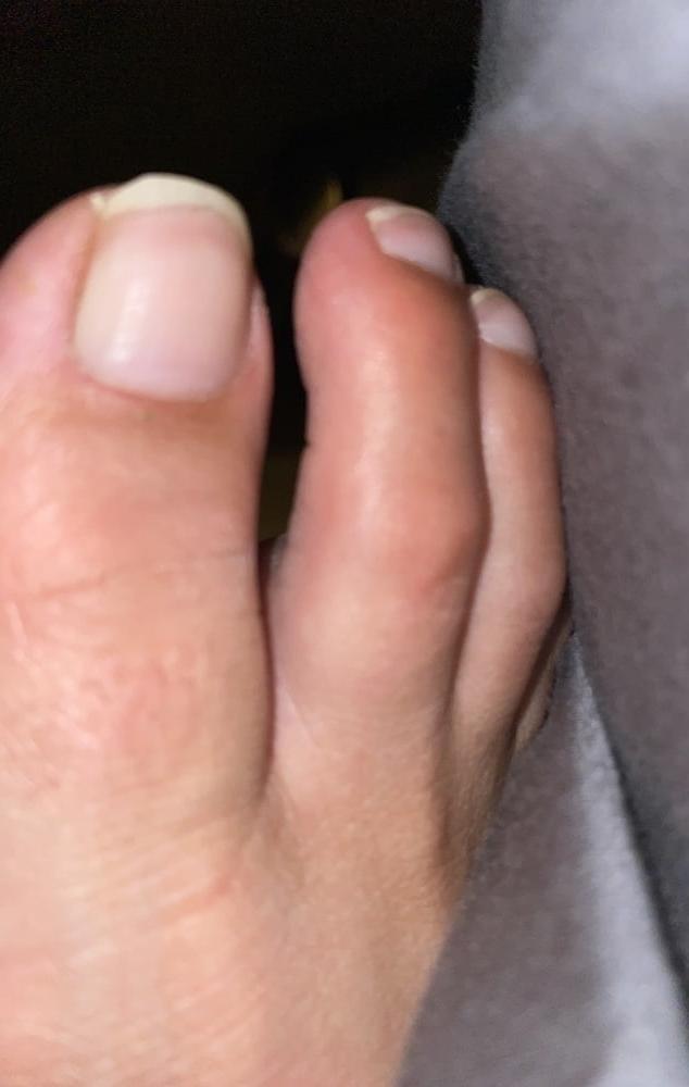 9P Perfect toes