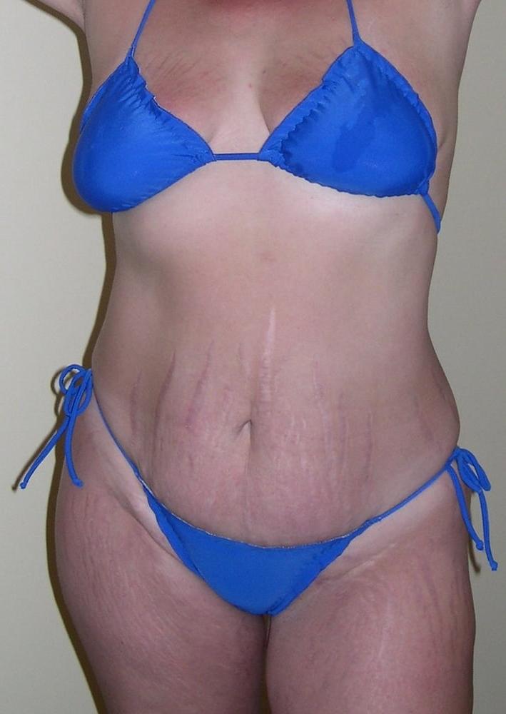 25P Belly Worship