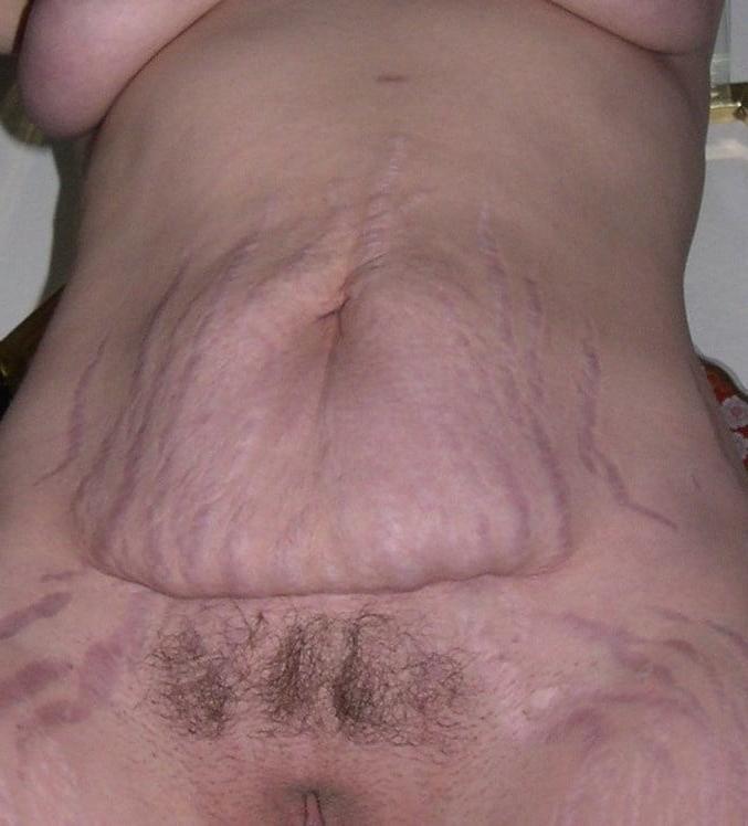 25P Belly Worship