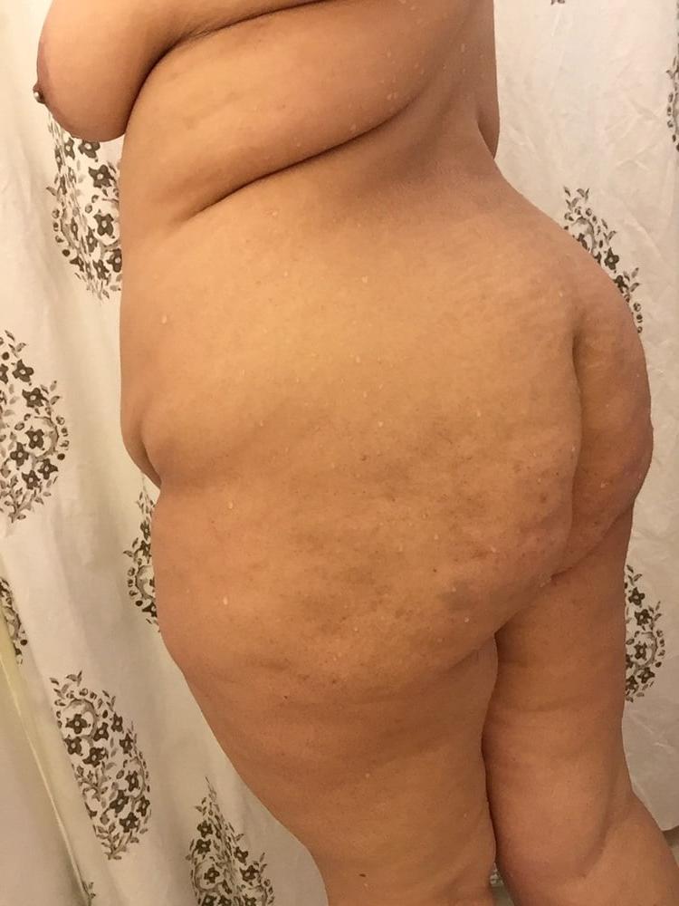 25P Big Belly