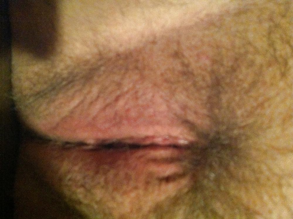 17P Fat pussy slut