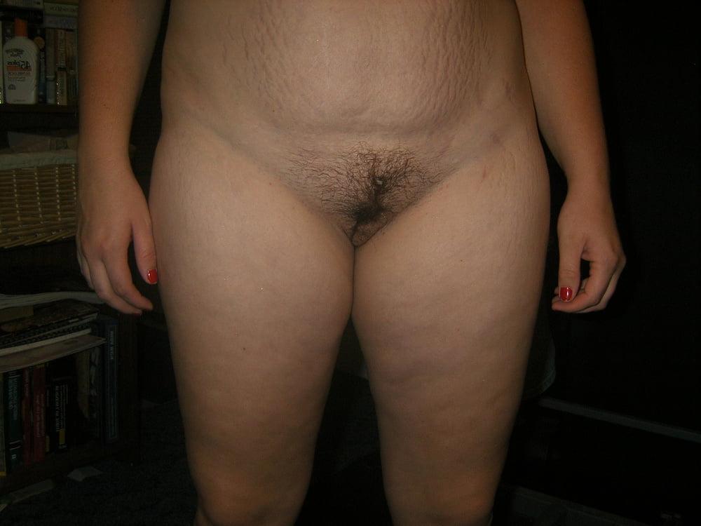 25P Cellulite saggy tits belly mommy tummy stretch maks pt 9
