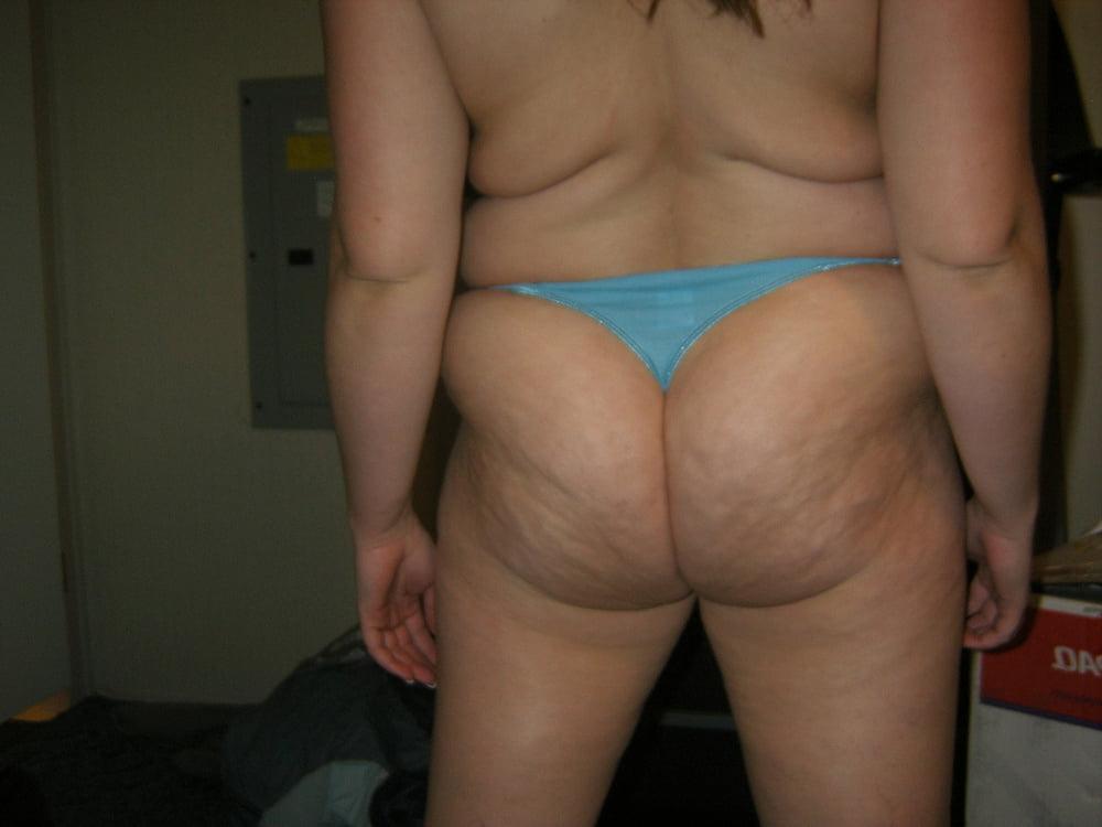 25P Cellulite saggy tits belly mommy tummy stretch maks pt 8