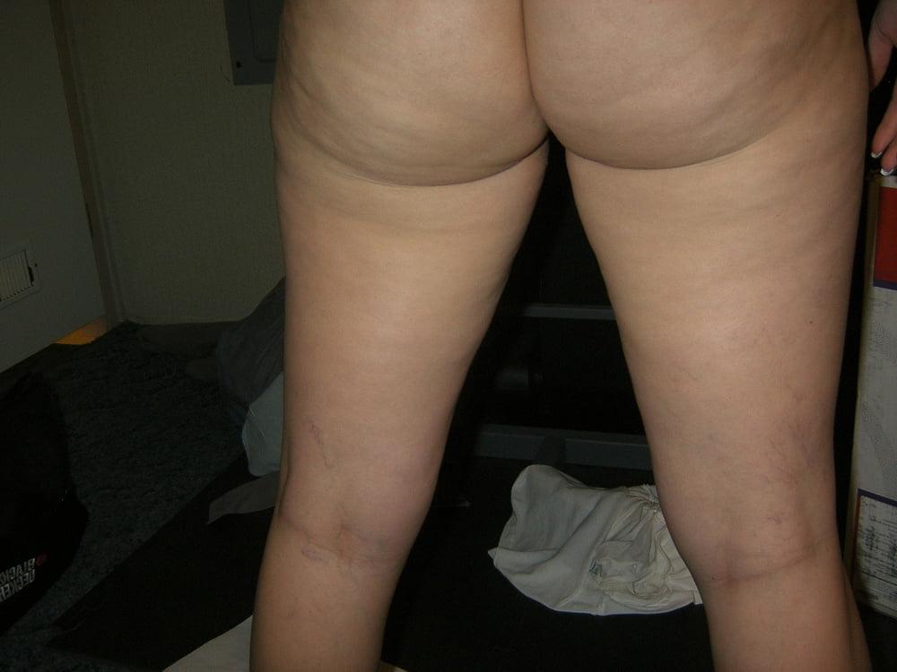 25P Cellulite saggy tits belly mommy tummy stretch maks pt 8
