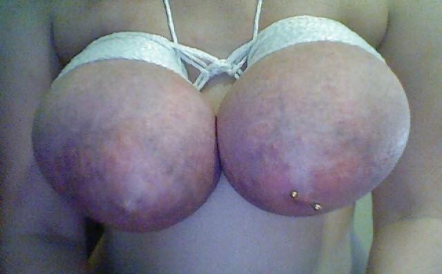 25P Big Natural Boobs Tortured With Over 100 pegs