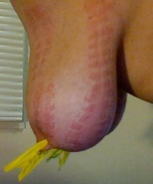 25P Big Natural Boobs Tortured With Over 100 pegs