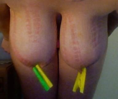 25P Big Natural Boobs Tortured With Over 100 pegs