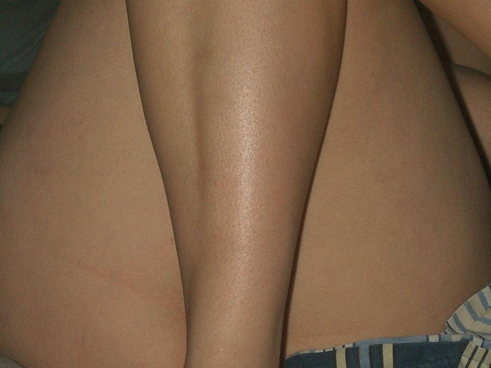 25P Cellulite saggy tits belly mommy tummy stretch maks pt 4