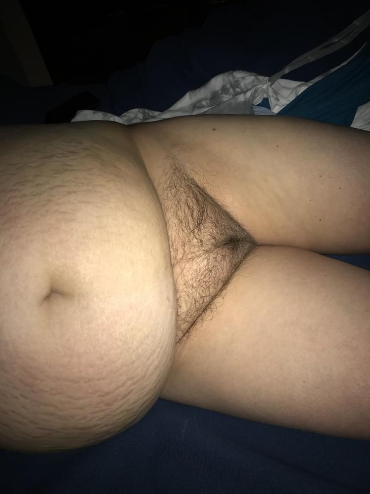 25P Belly full of Stretchmarks 44