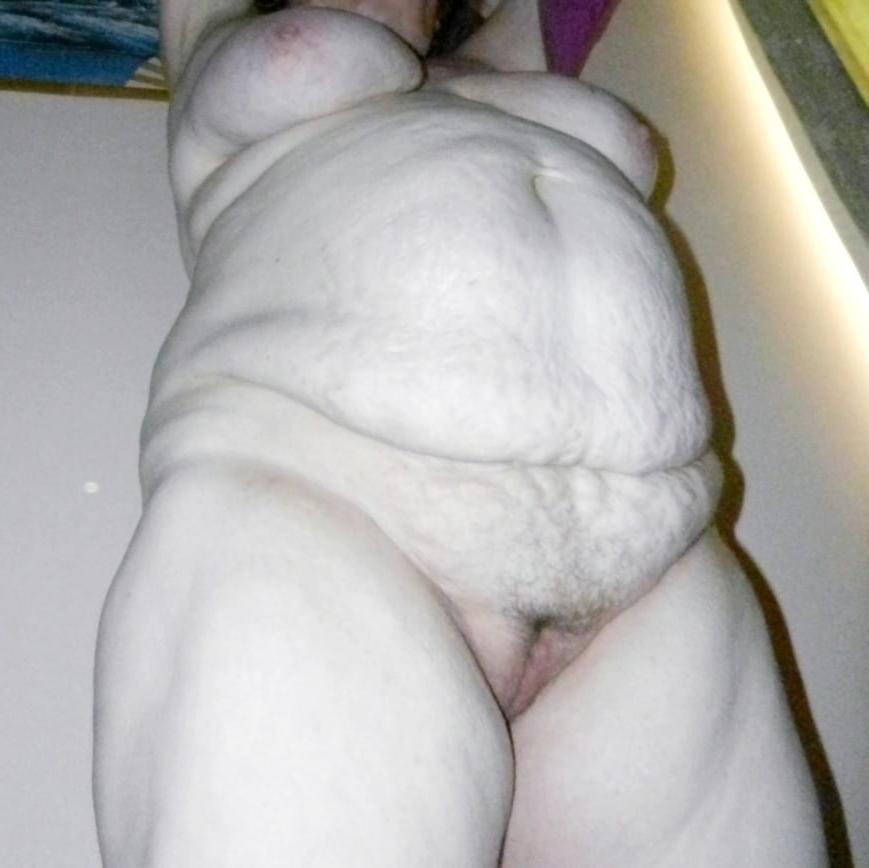 25P Belly full of Stretchmarks 44