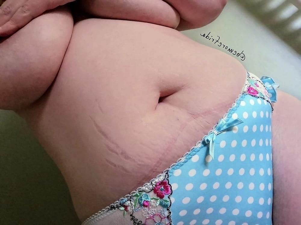 25P Belly full of Stretchmarks 42