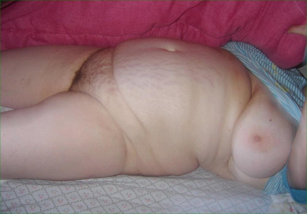 25P Belly full of Stretchmarks 43