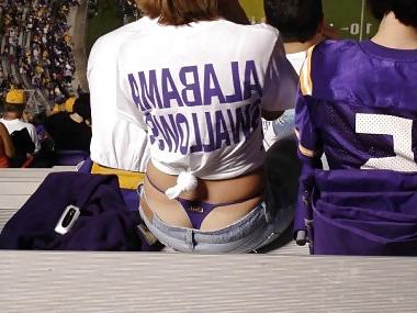 7P Whale Tail and camel toes