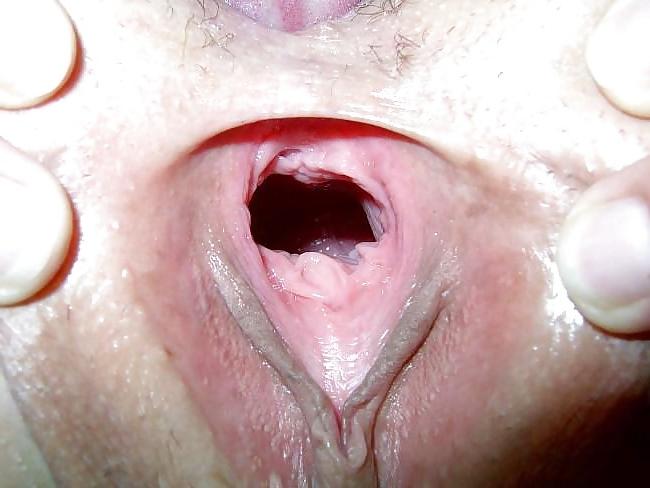 25P GAPE - 4