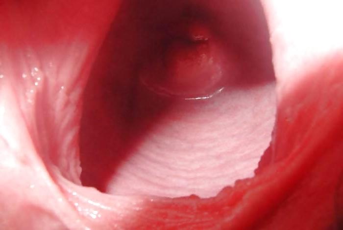 25P GAPE - 4