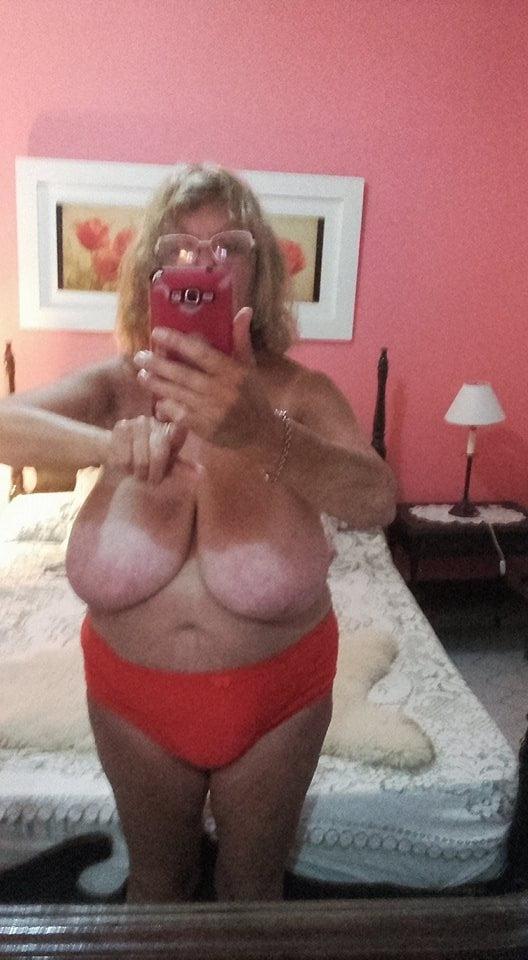 8P 61 yo friend