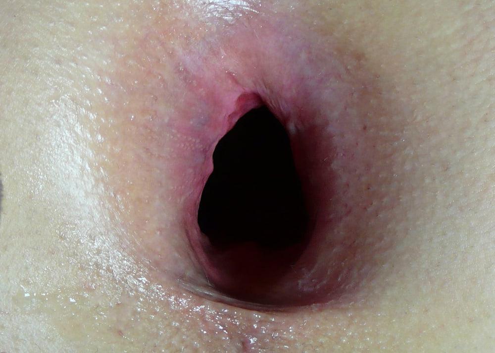 12P 10 years at xhamster, the beginning of GAPE 2011! Pt.1