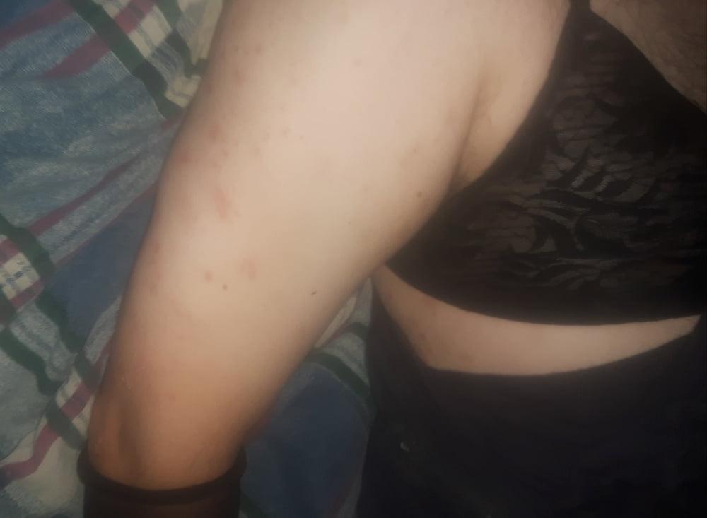 25P Legs in the air (1st tiime of 2020) summer