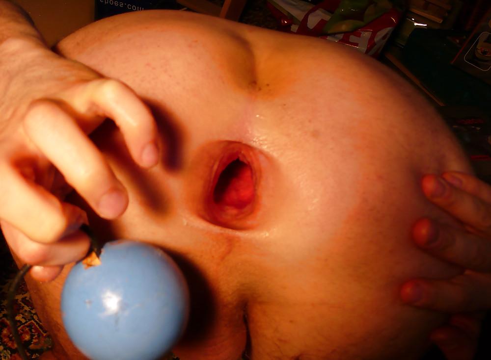 12P A lot of things in my asshole. big gape 7cm! Mrz2011