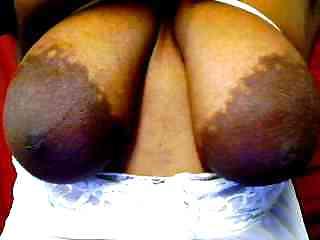 25P Looking out for more of these huge areolas