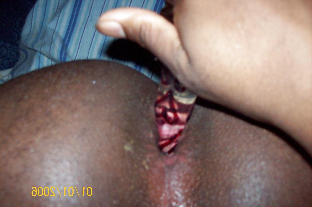 5P My gaping ass hole