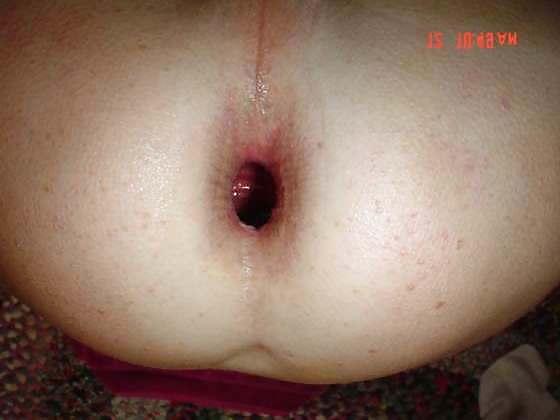 4P My gaping hole