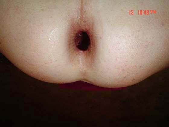 4P My gaping hole