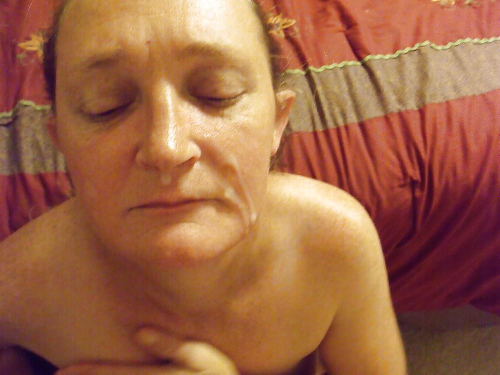 17P Cameltoefacial