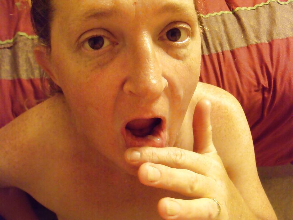 17P Cameltoefacial