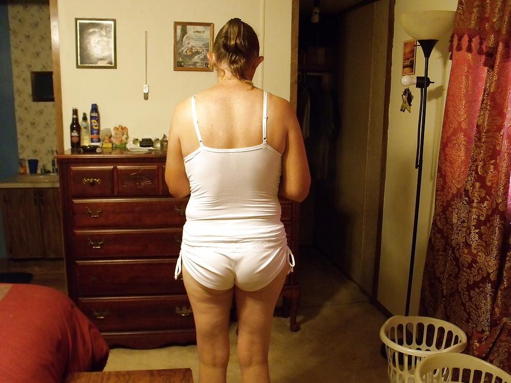 17P Cameltoefacial