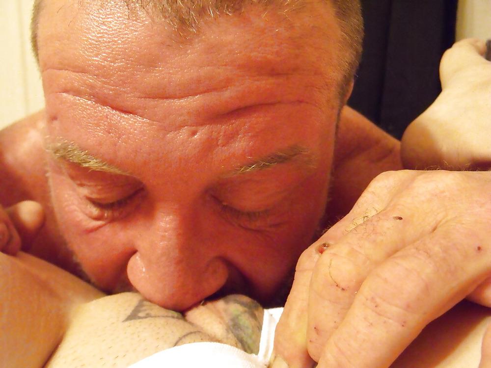 17P Cameltoefacial