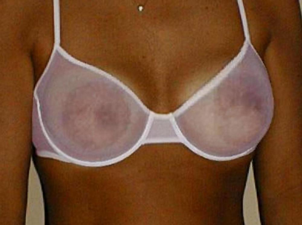 19P Huge areolas