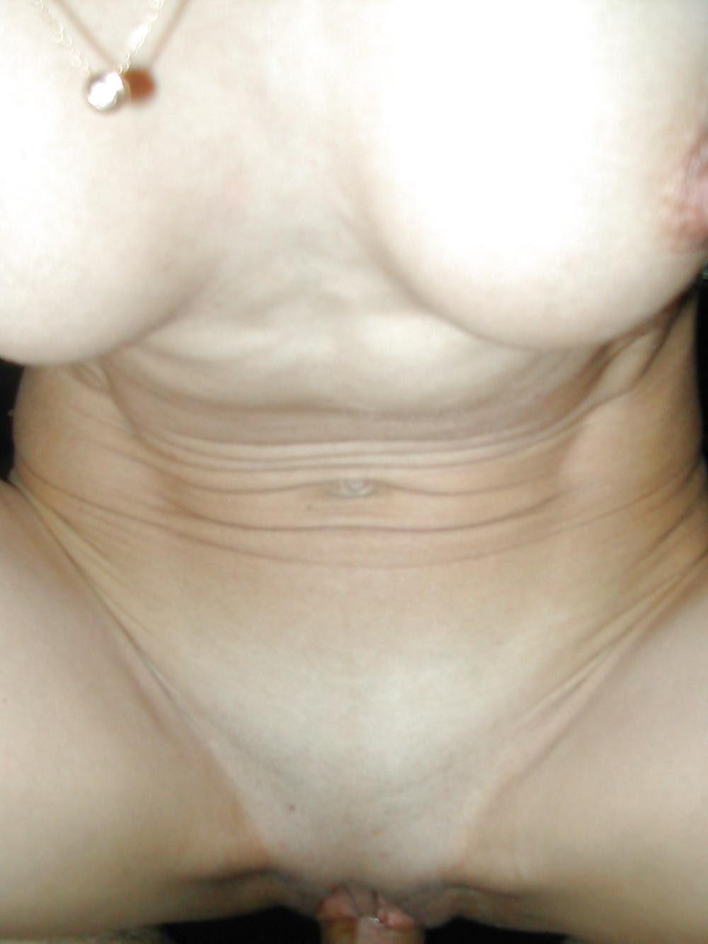 20P Skinny 1