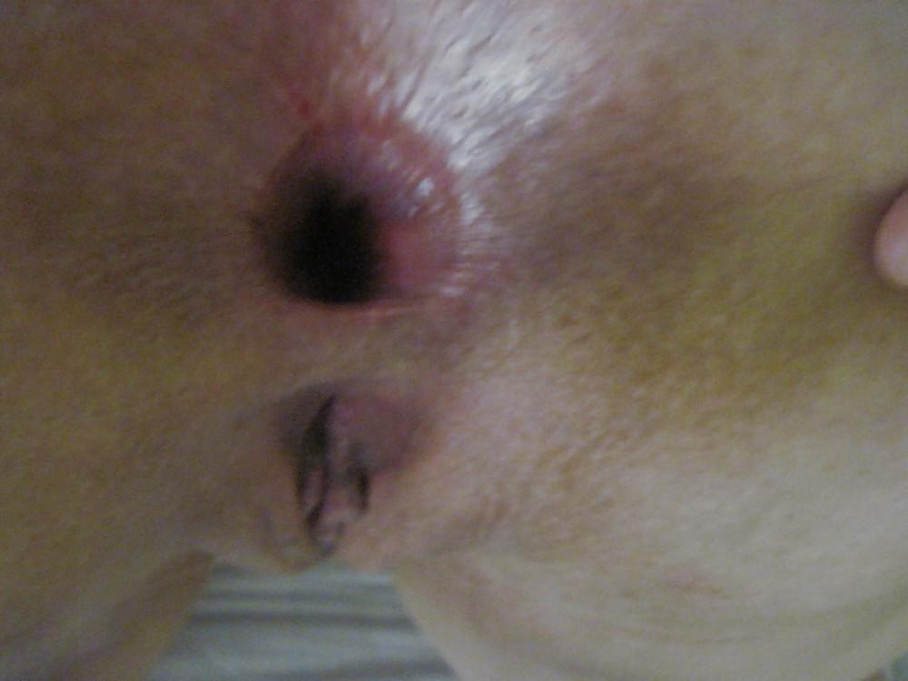 6P My gape