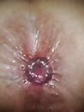 25P Fotos de bucetas, cu e peitos, pics pussy ass hole big tits