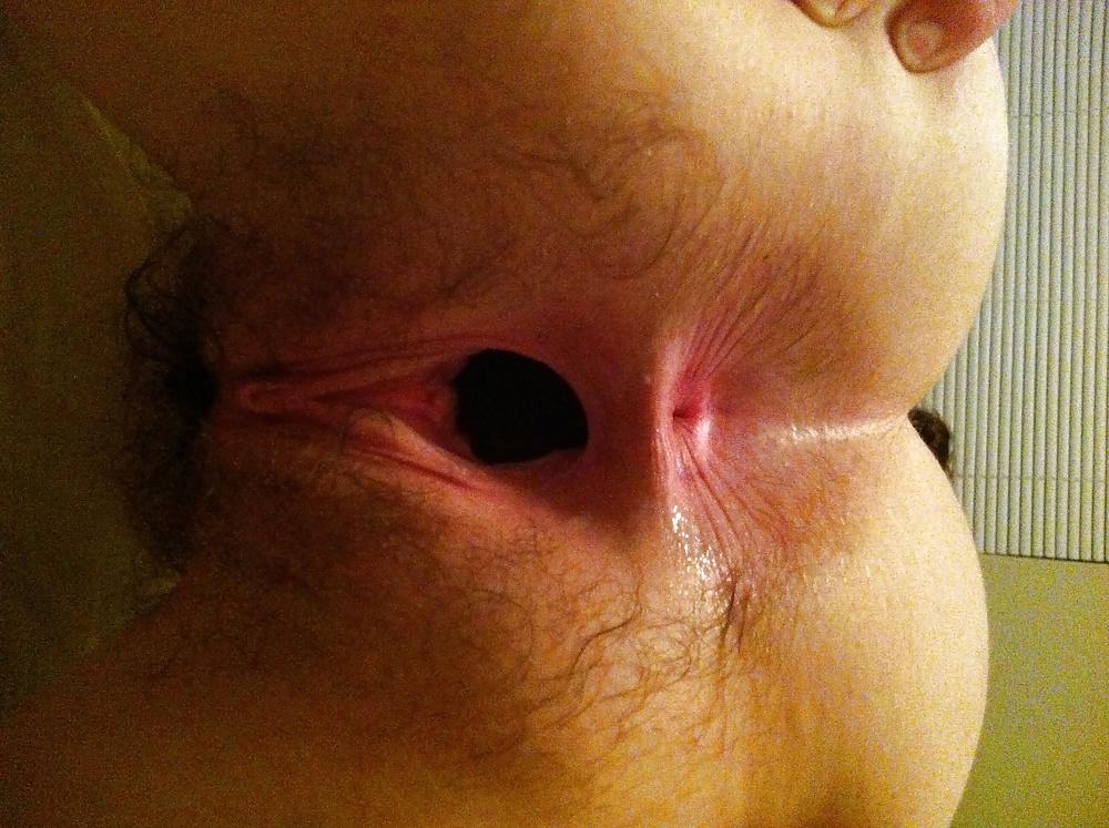 5P My gaping hole