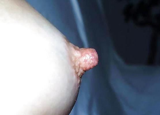 25P Huge breast & nipples