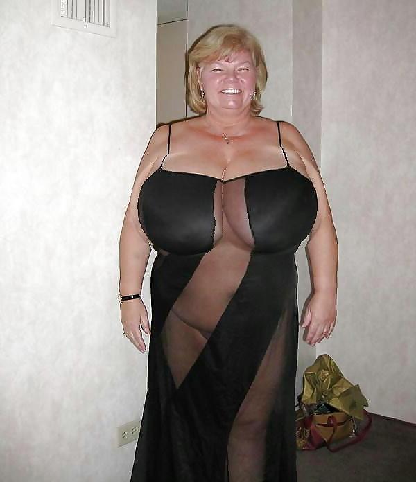 24P Breast jobs make tits bigger for huge fun