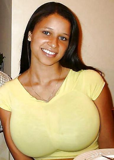 24P Breast jobs make tits bigger for huge fun