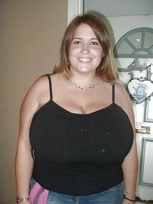 24P Breast jobs make tits bigger for huge fun