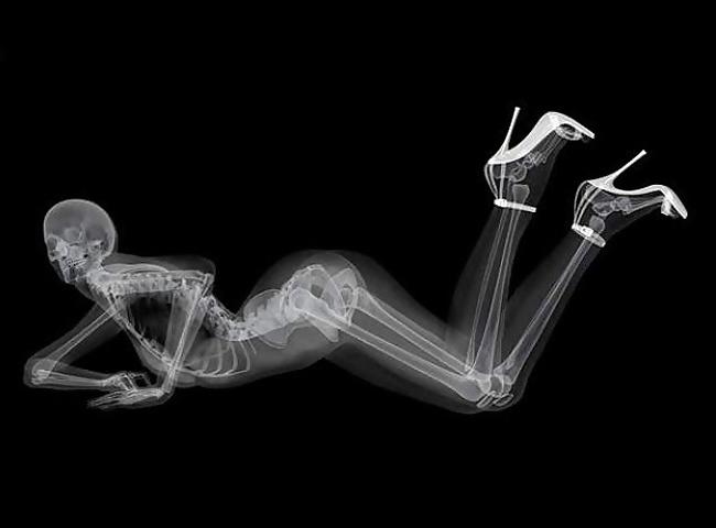 12P Very skinny chick