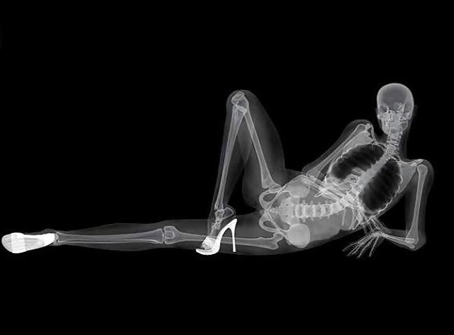 12P Very skinny chick